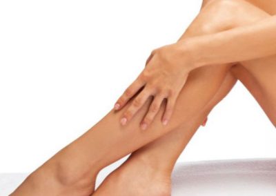 Laser Hair Removal