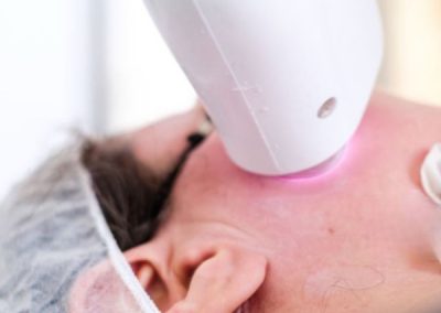 Laser Hair Removal Bradford