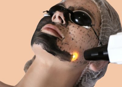 Carbon Skin Care