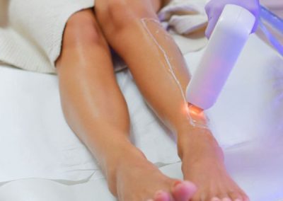 Lumiere Hair Removal Bradford